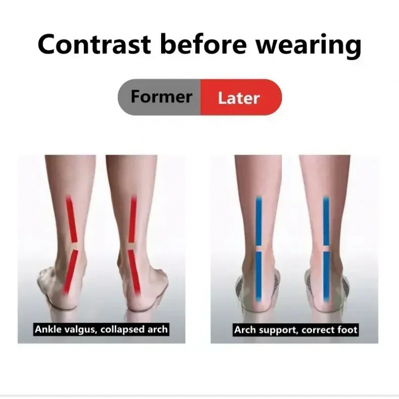 2 Pcs EVA Flat Feet Arch Suppo - Men Shoes Outlet のレビューと価格
